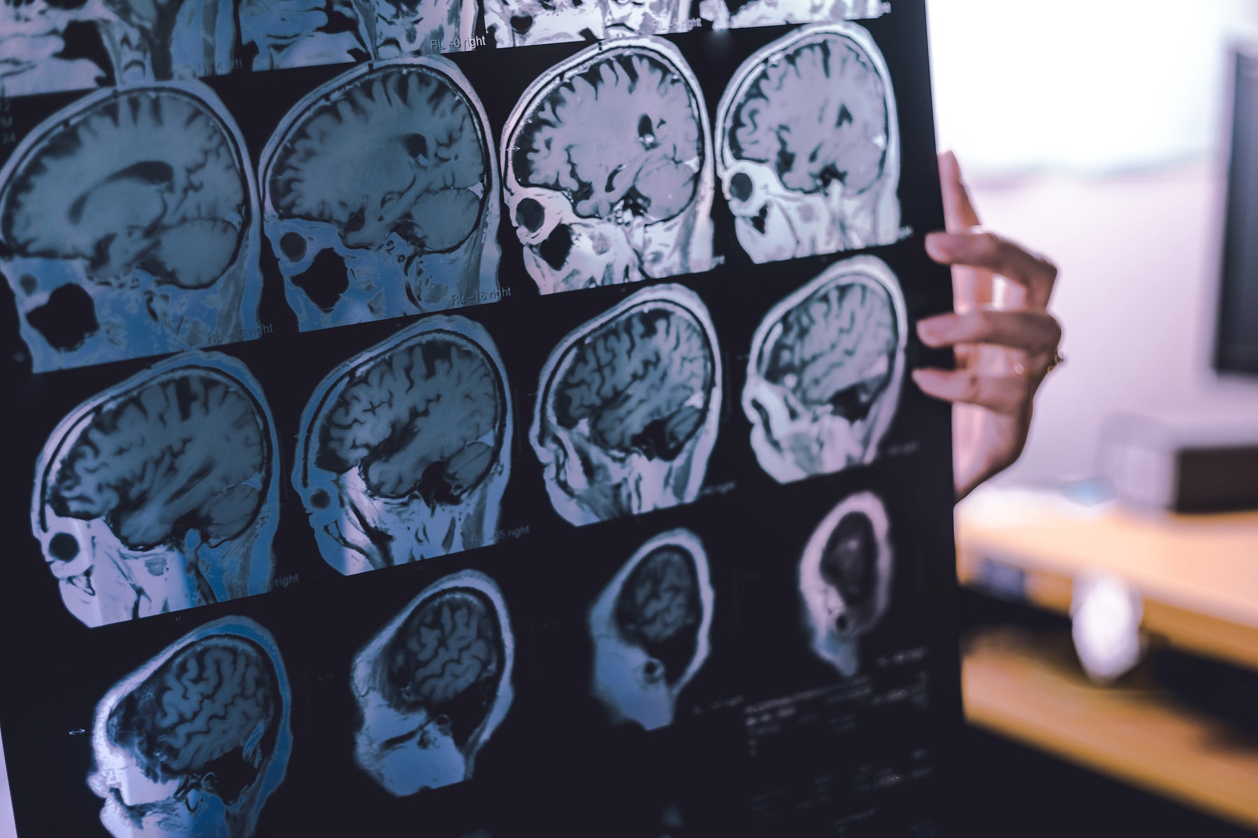 The Connection Between Air Pollution and Dementia