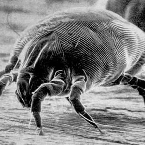 Dust mites invisible but still there